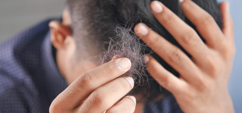 ARE YOU TRYING TO PREVENT HAIR LOSS?